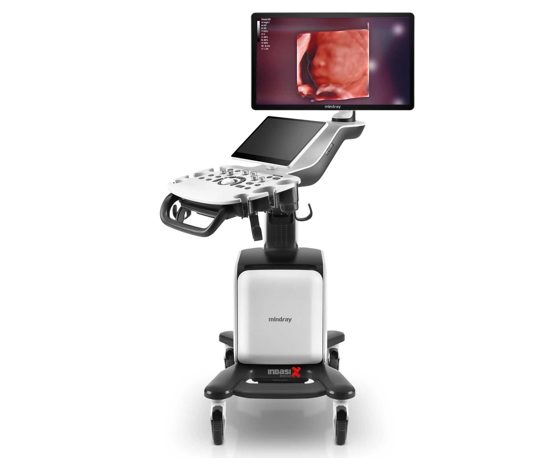 Ultrasonido Mindray CONSONA N7 incluye transductor Convexo + Lineal GINECOLOGÍA GABINETE HUMANO