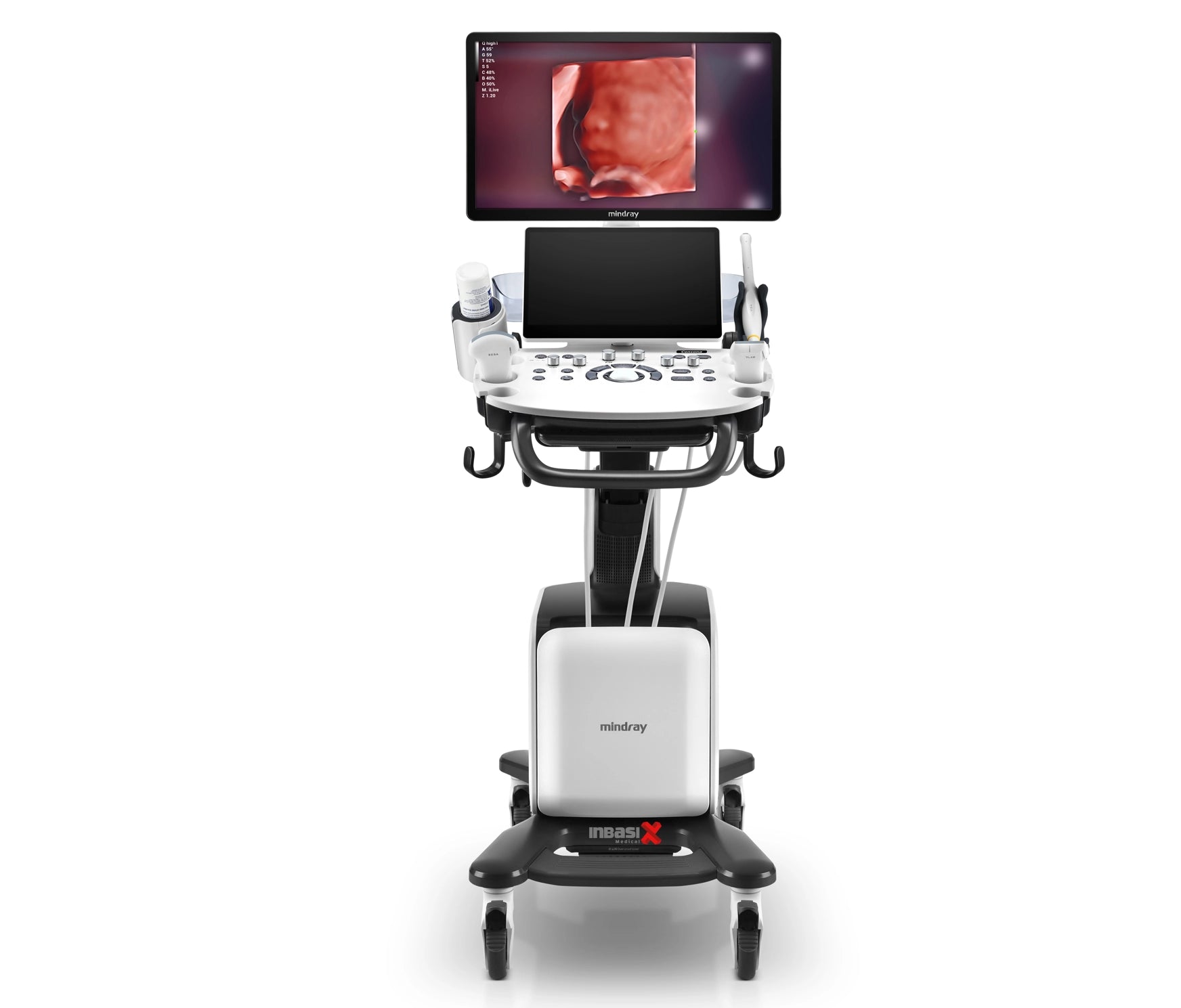 Ultrasonido Mindray CONSONA N7 incluye transductor Convexo + Lineal GINECOLOGÍA GABINETE HUMANO