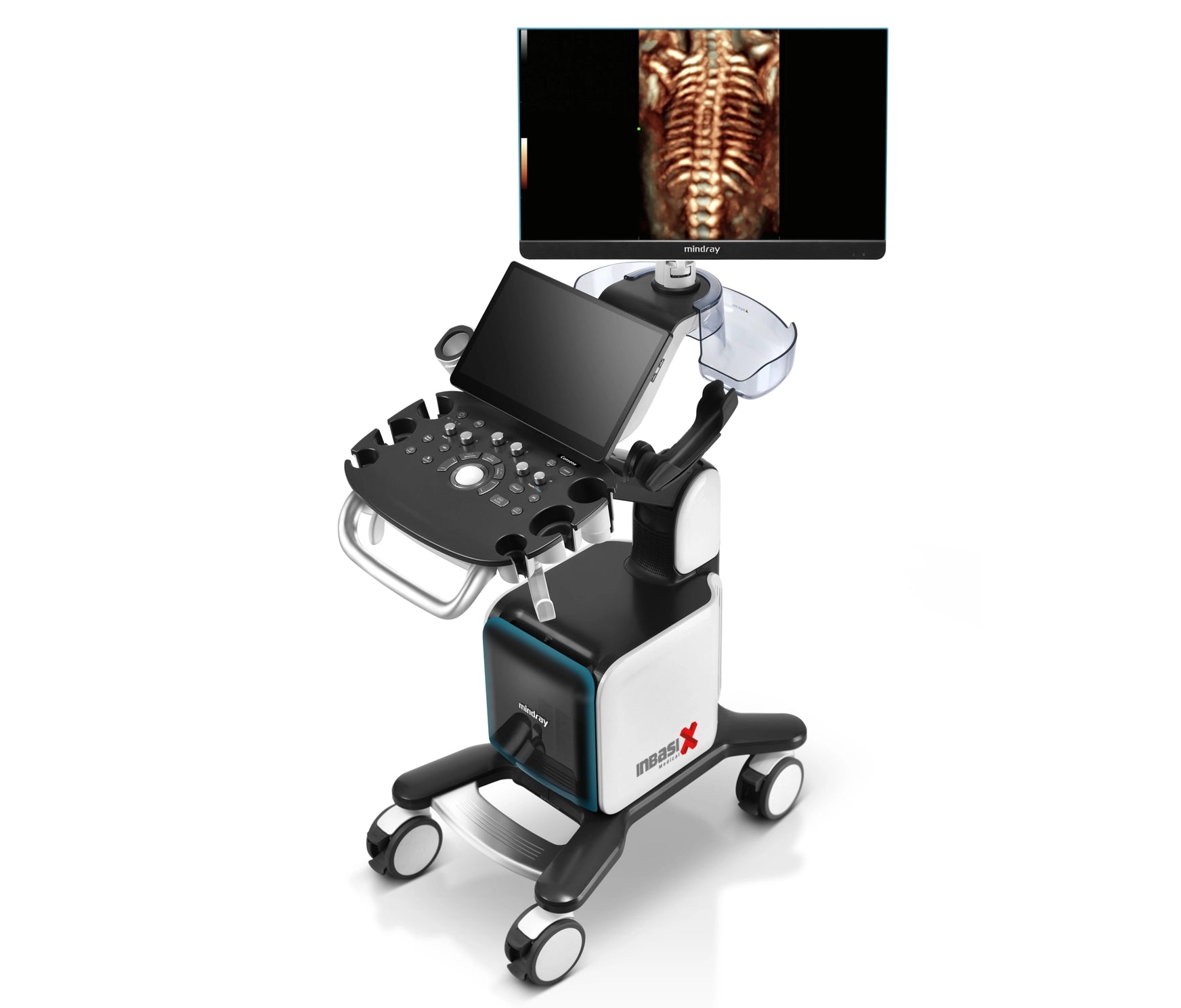 Ultrasonido Mindray CONSONA N9 incluye transductor Convexo + Lineal GINECOLOGÍA GABINETE HUMANO