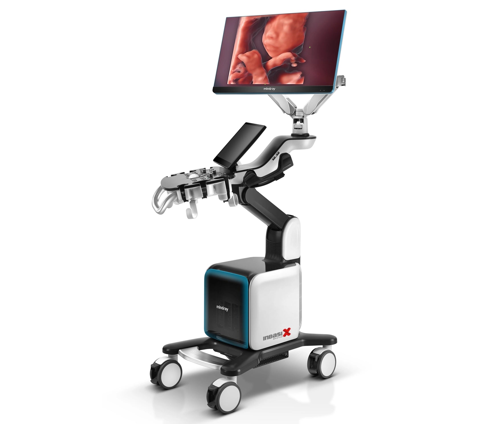 Ultrasonido Mindray CONSONA N9 incluye transductor Convexo + Lineal GINECOLOGÍA GABINETE HUMANO