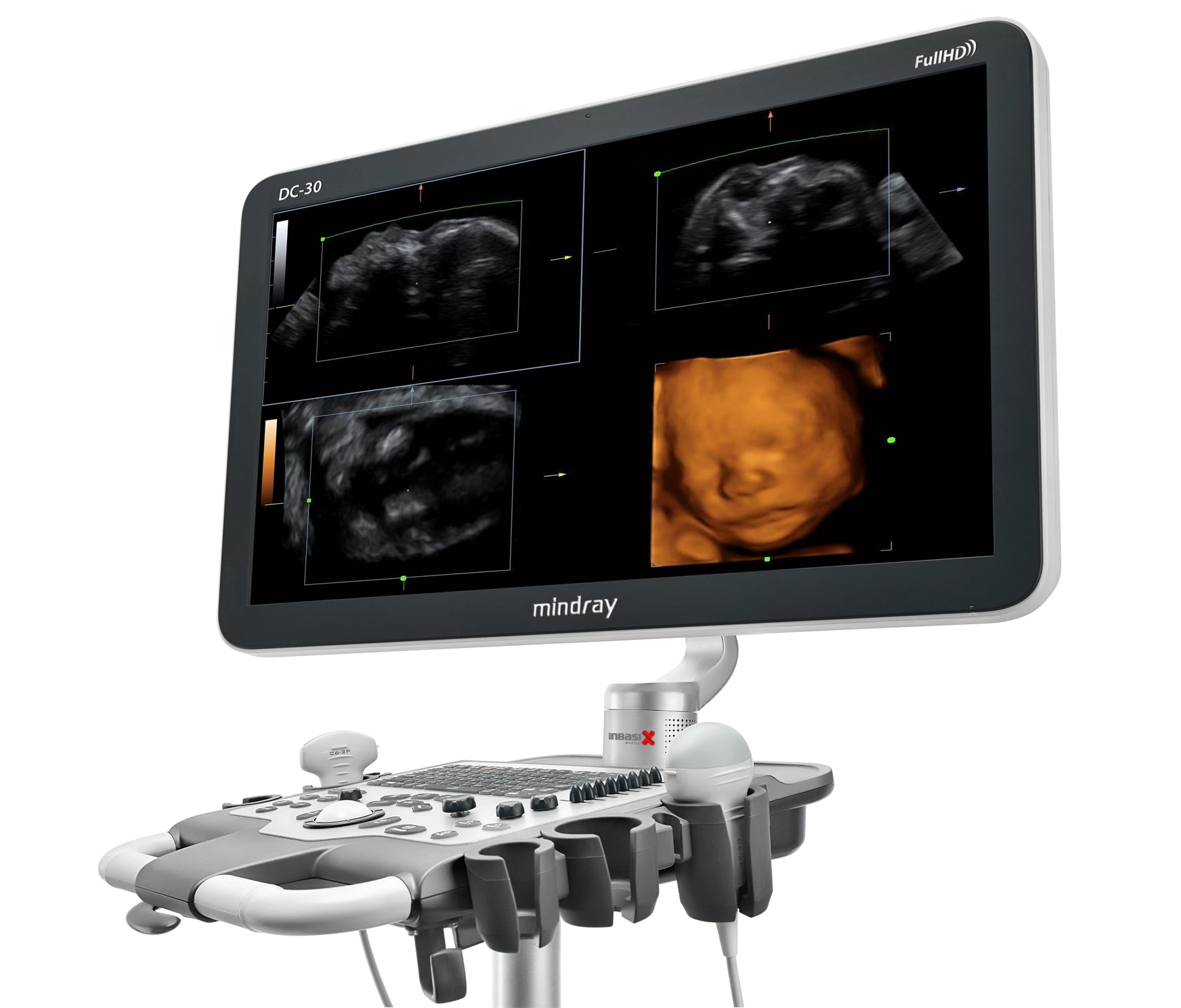 Ultrasonido Mindray DC30 Full HD incluye transductor Volumétrico + Vaginal GINECOLOGÍA GABINETE HUMANO