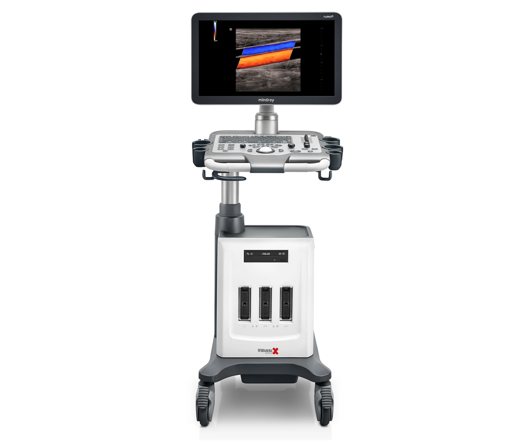 Ultrasonido Mindray DC30 Full HD incluye transductor Volumétrico + Vaginal GINECOLOGÍA GABINETE HUMANO