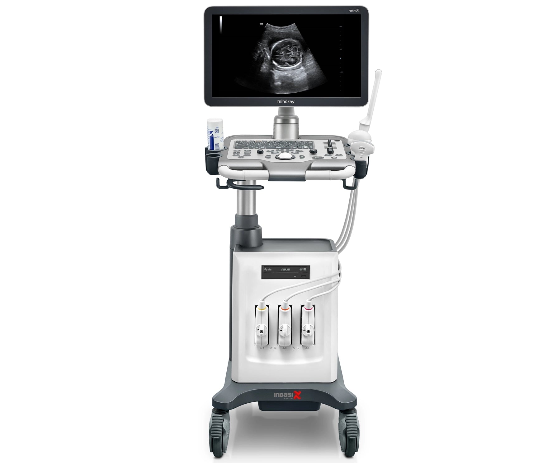 Ultrasonido Mindray DC30 Full HD incluye transductor Volumétrico + Vaginal GINECOLOGÍA GABINETE HUMANO