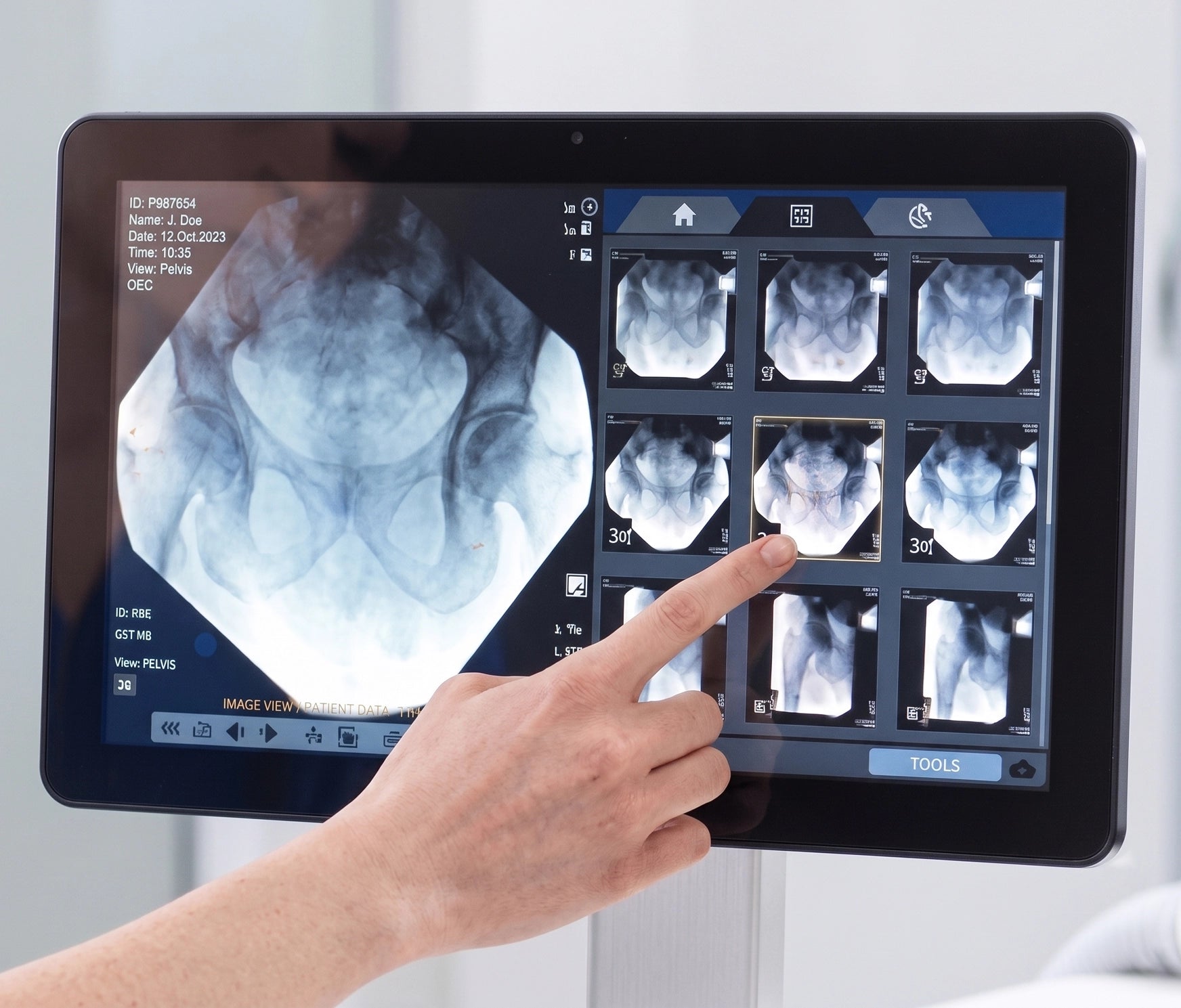 GE HealthCare OEC 9900 - Arco en C