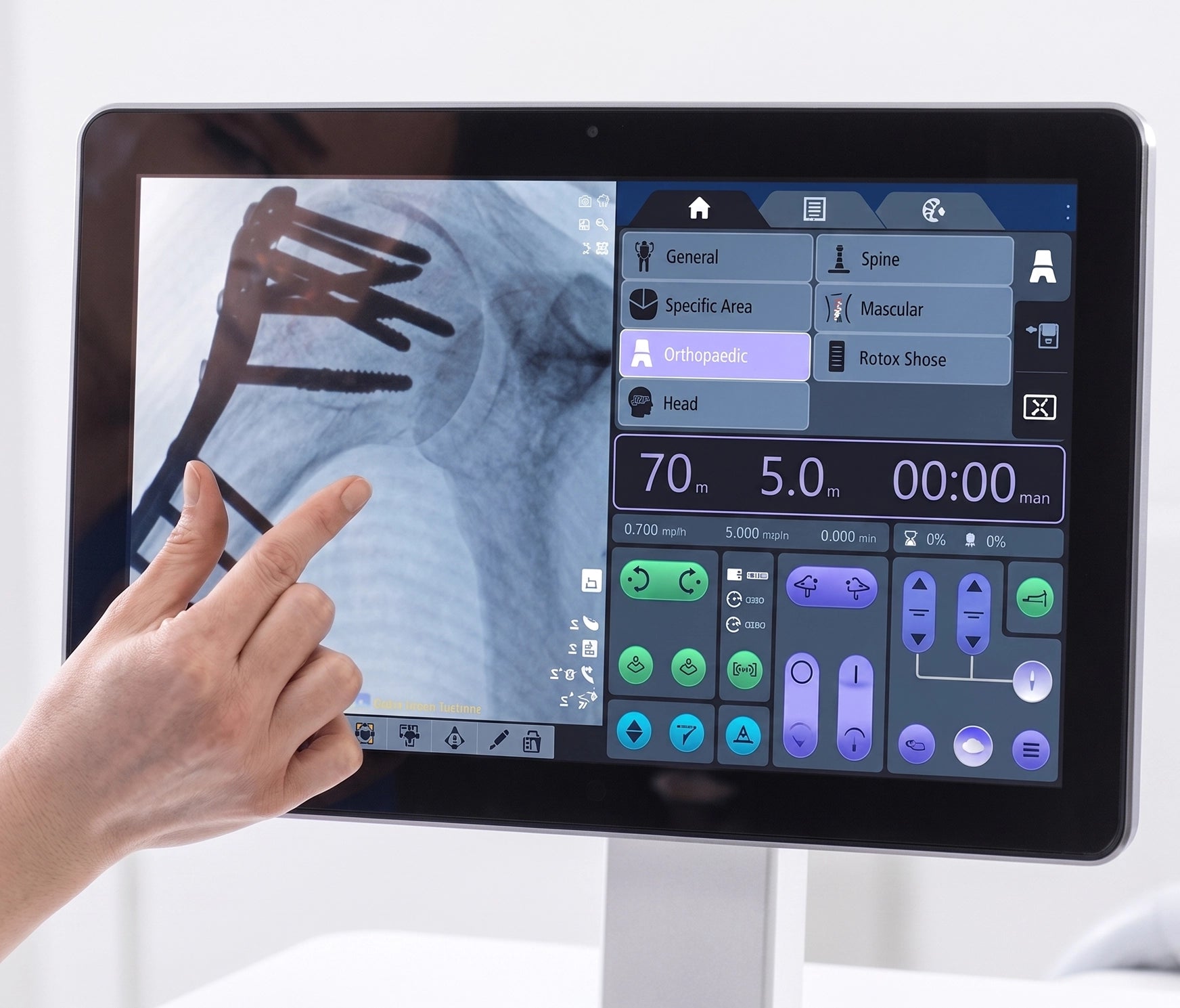 GE HealthCare OEC 9900 - Arco en C