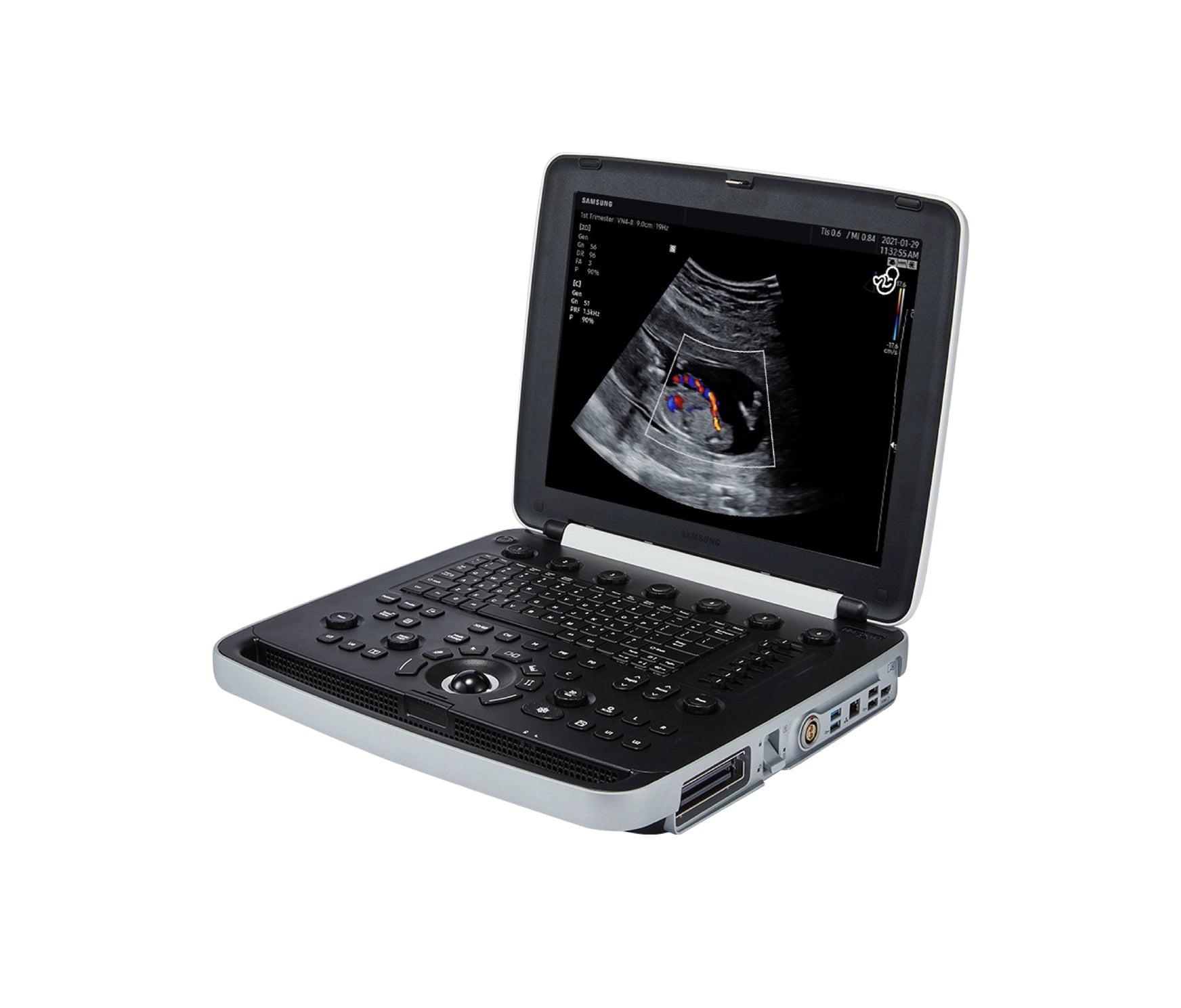 Ultrasonido Portátil Samsung HM70 EVO incluye Transductor Volumétrico + Vaginal GINECOLOGÍA PORTÁTIL SAMSUNG