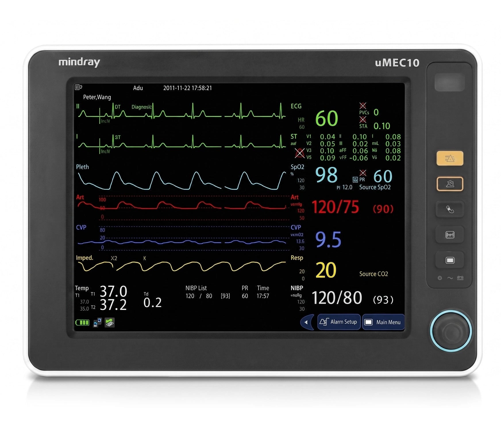 Monitores Mindray UMEC (UMEC10 y UMEC 12)