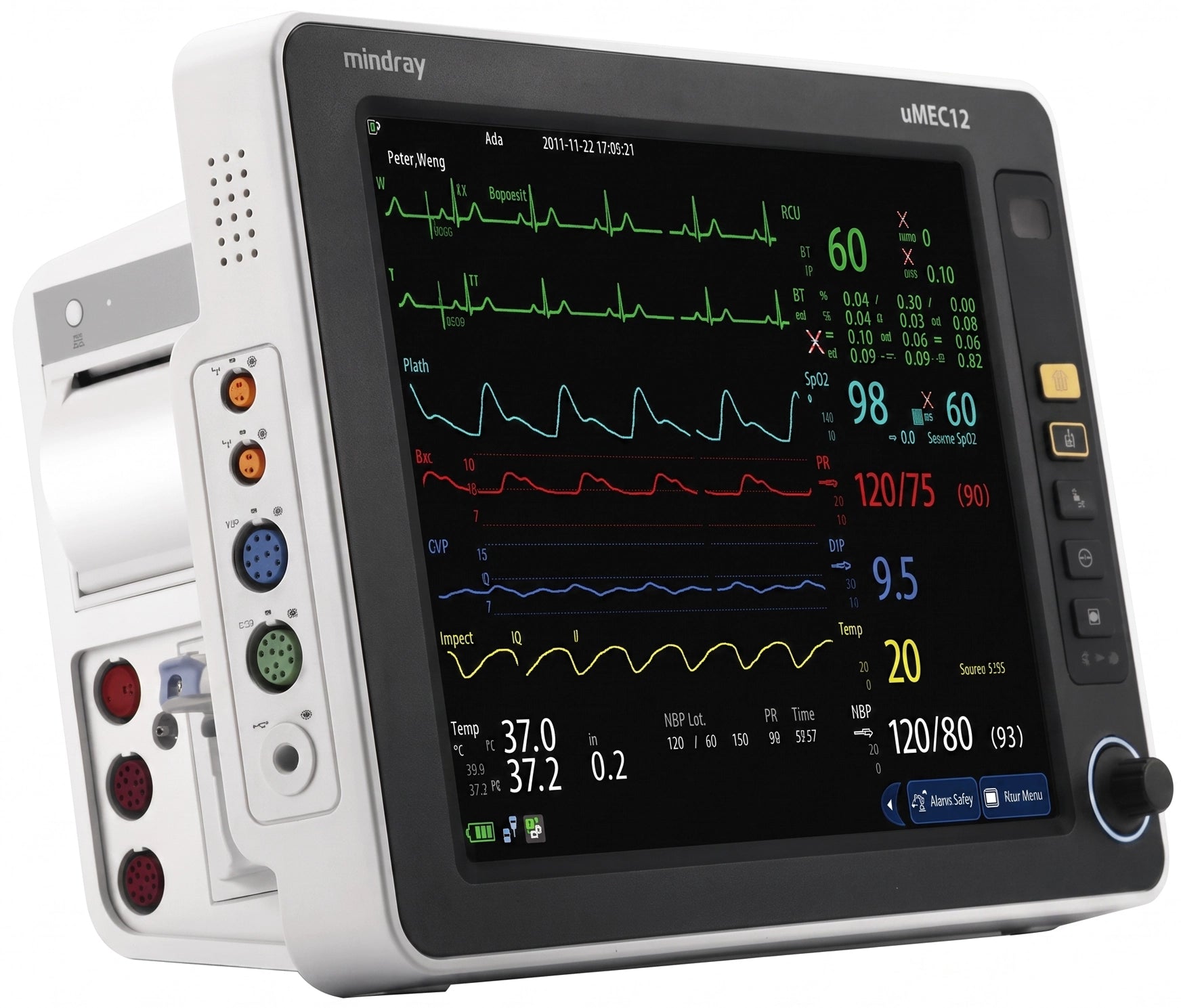 Monitores Mindray UMEC (UMEC10 y UMEC 12)