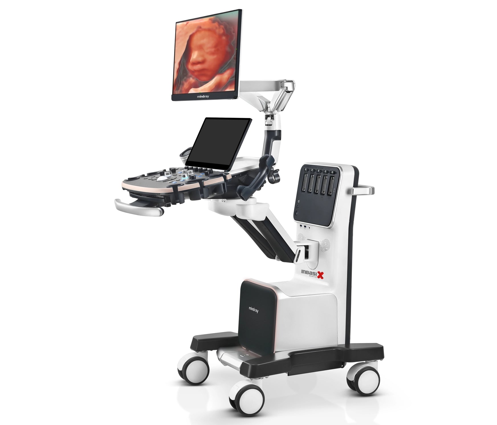 Ultrasonido Mindray NUEWA i9 incluye transductor convexo + endocavitario GINECOLOGÍA GABINETE HUMANO