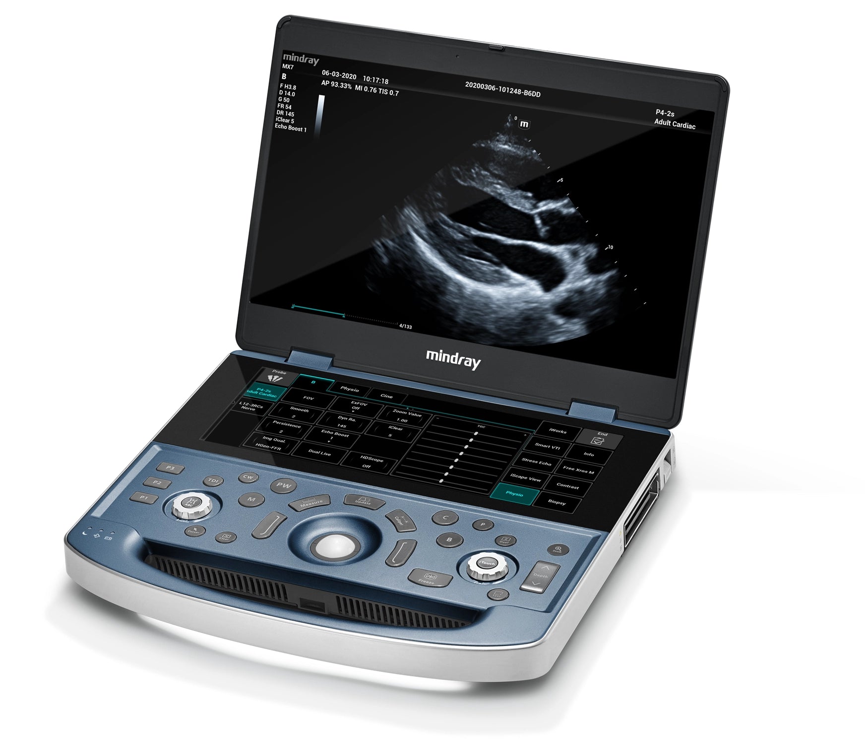 Ultrasonido Mindray MX7 con transductor lineal L20-5S "6-23MHz"- ESTÉTICA PORTÁTIL HUMANO
