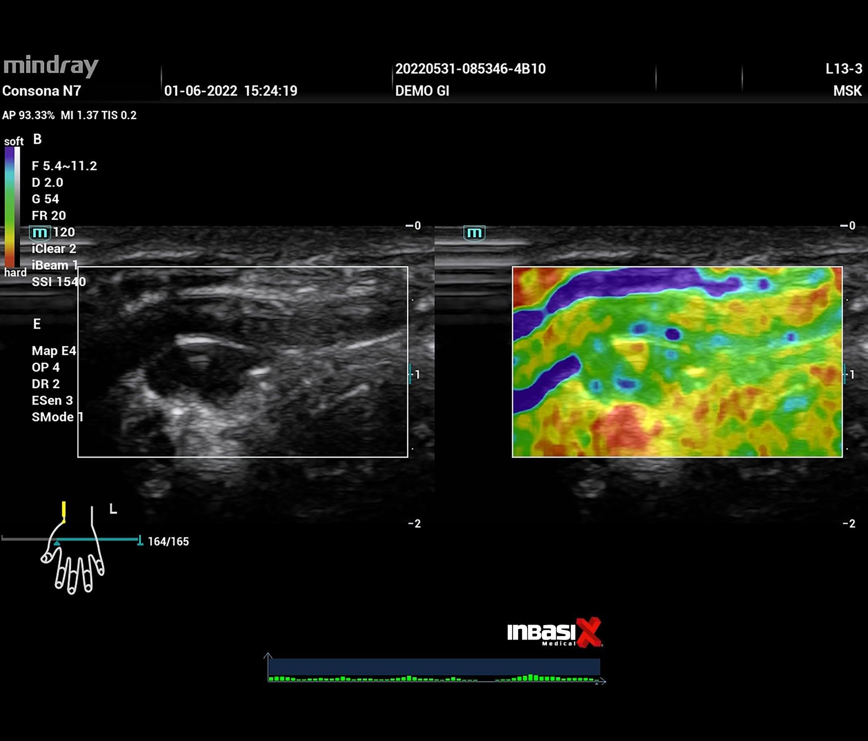 Ultrasonido Mindray CONSONA N7 incluye transductor Convexo + Lineal GINECOLOGÍA GABINETE HUMANO