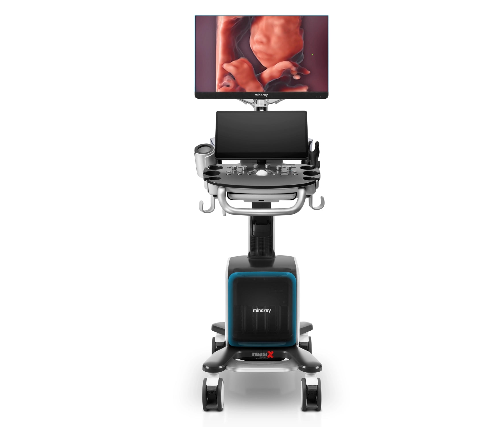Ultrasonido Mindray CONSONA N9 incluye transductor Convexo + Lineal GINECOLOGÍA GABINETE HUMANO
