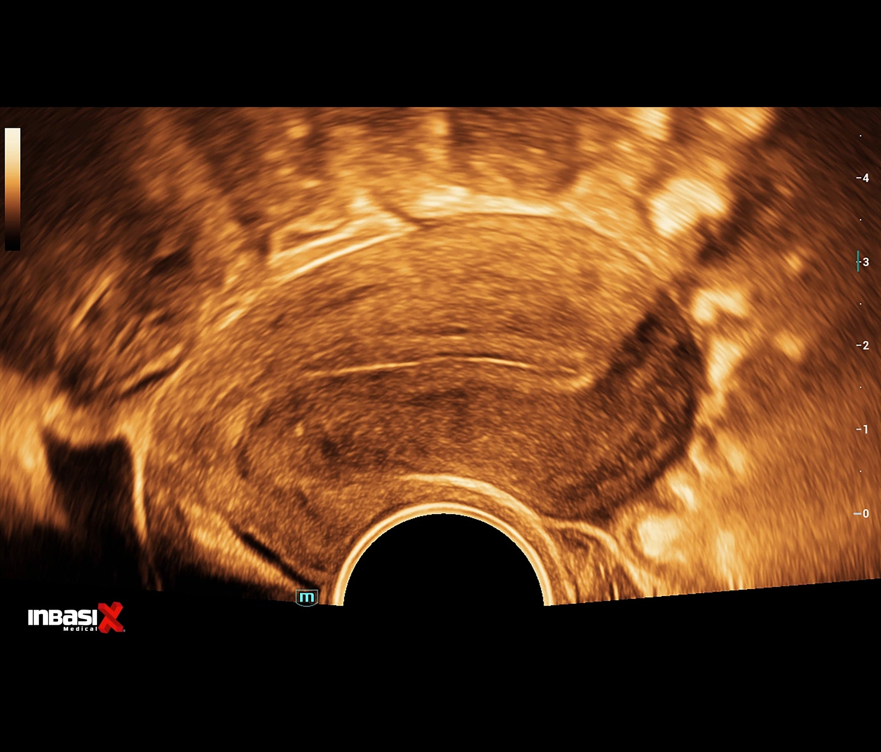 Ultrasonido Mindray CONSONA N9 incluye transductor Convexo + Lineal GINECOLOGÍA GABINETE HUMANO