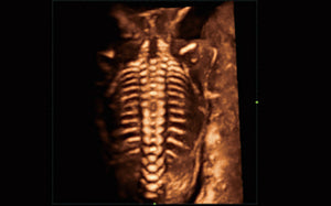 Columna fetal 3D