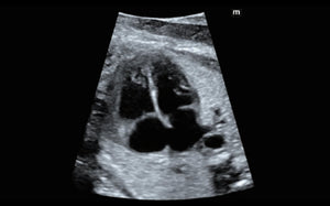 Corazón fetal