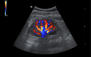 Kidney