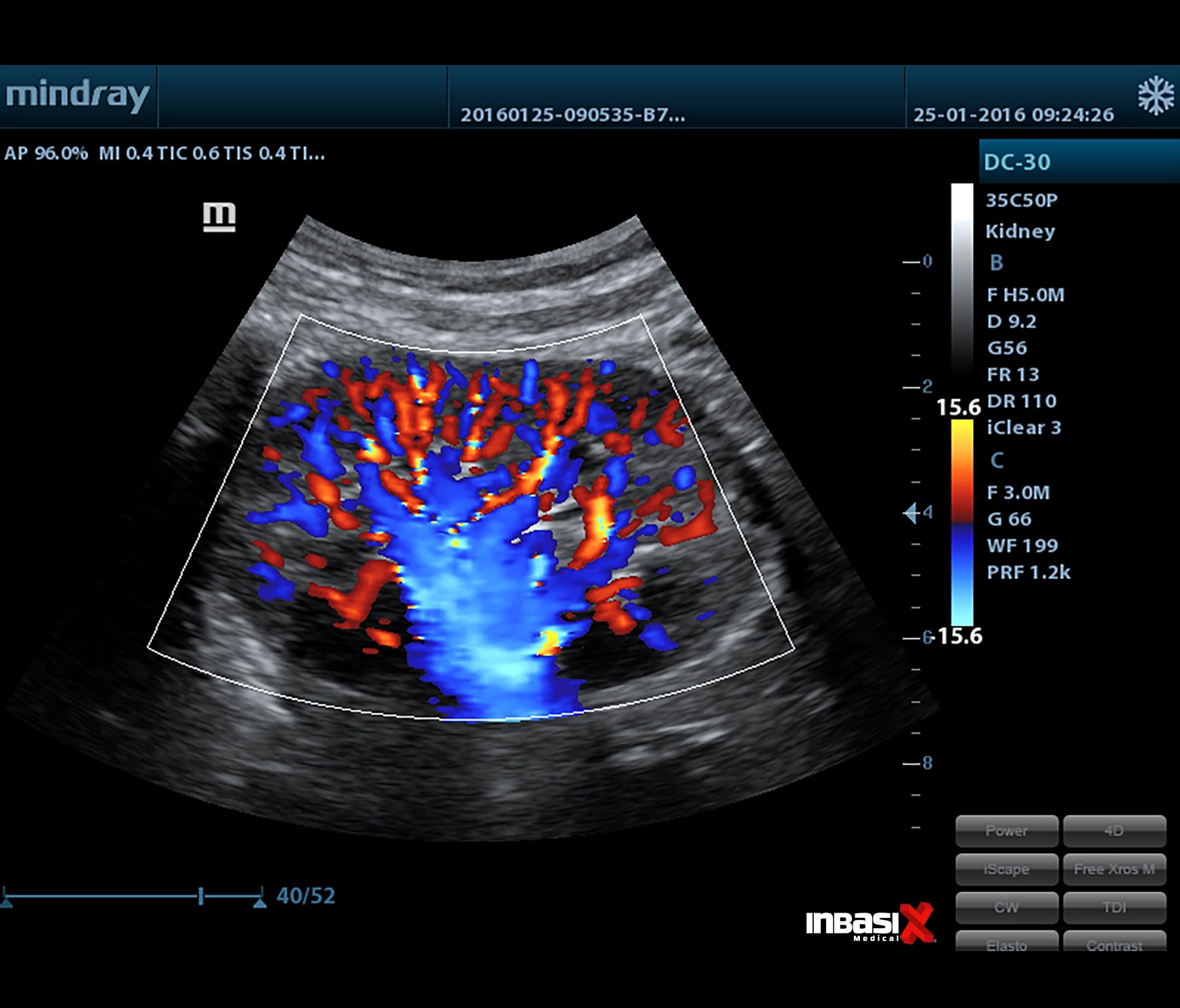 Ultrasonido Mindray DC30 Full HD incluye transductor Volumétrico + Vaginal GINECOLOGÍA GABINETE HUMANO