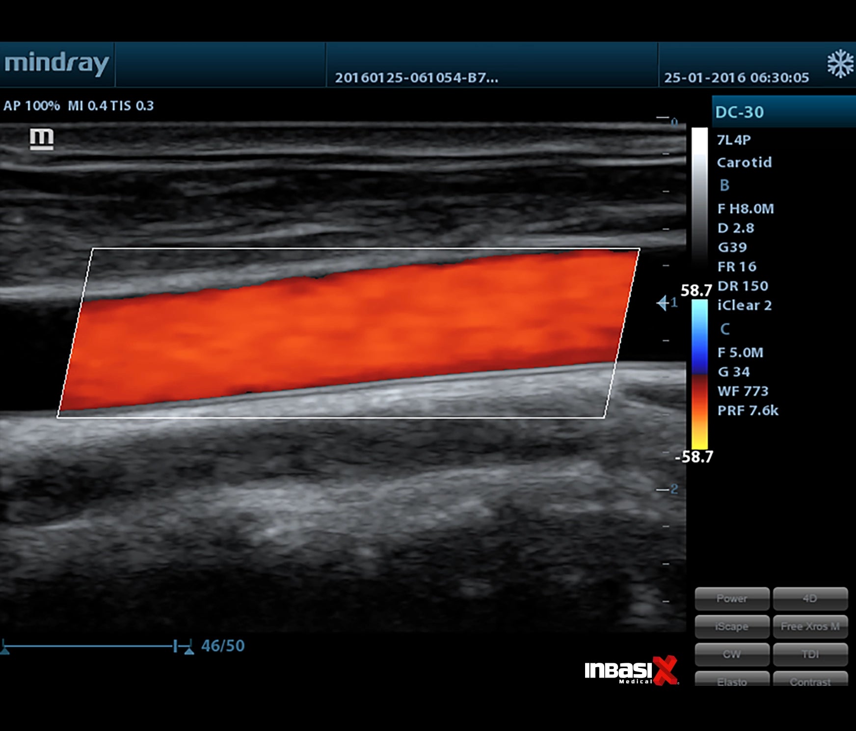 Ultrasonido Mindray DC30 Full HD incluye transductor Volumétrico + Vaginal GINECOLOGÍA GABINETE HUMANO