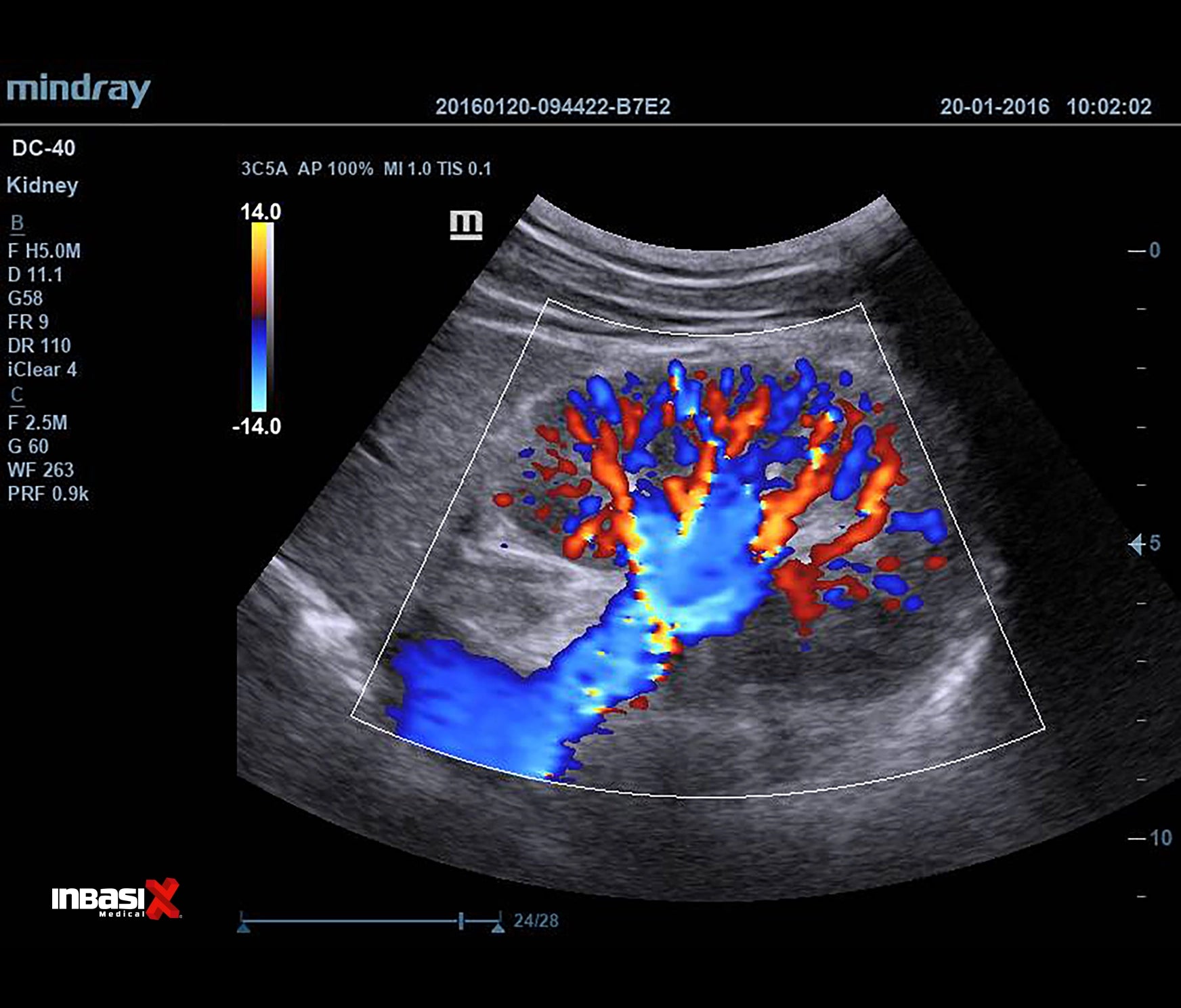 Ultrasonido Mindray DC40 FULL HD incluye transductor Volumétrico + Vaginal + Convexo GINECOLOGÍA