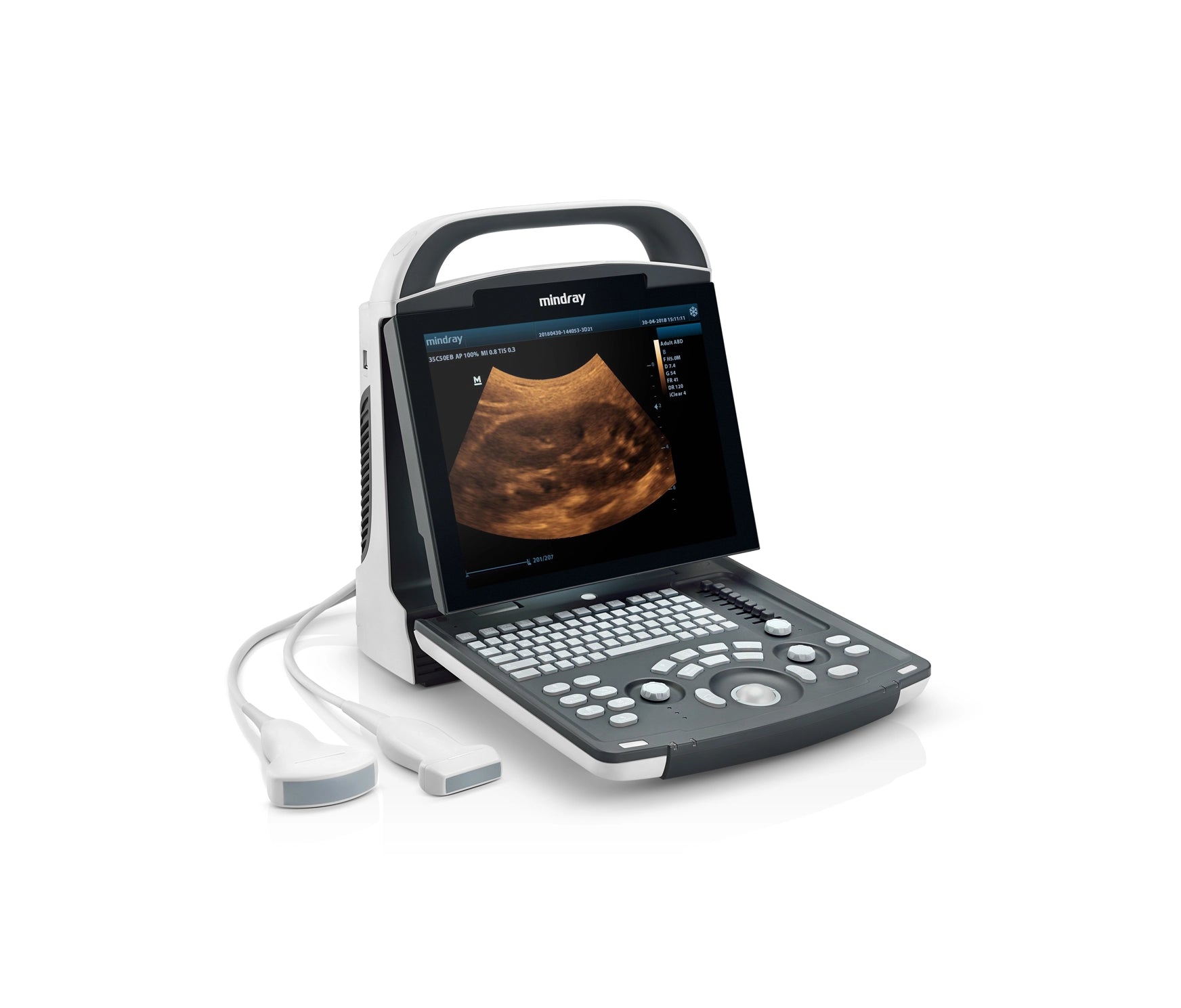 Ultrasonido Mindray DP30 - GINECOLOGÍA PORTÁTIL HUMANO