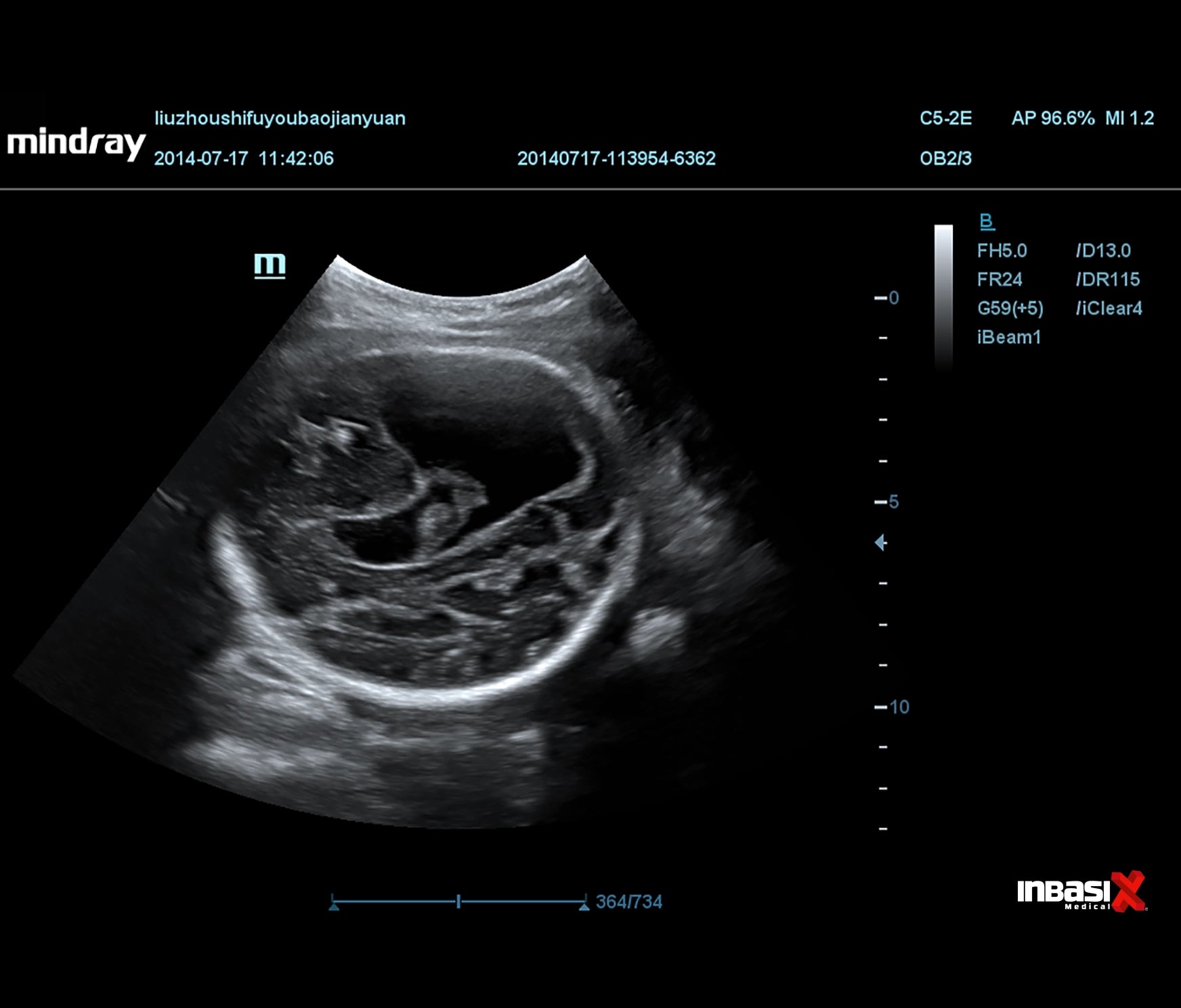Ultrasonido Mindray DP20 Incluye Transductores Convexo + Lineal GINECOLOGÍA PORTÁTIL HUMANO