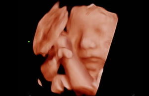 Fetal face 3D