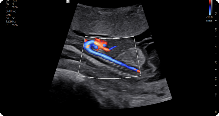 Show blood flow in vessels in a 3D like display