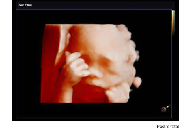 RealisticVue™