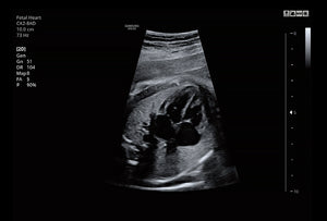 Corazón fetal