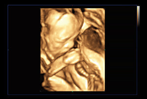 2nd trimester