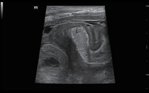 Imagen intestinal