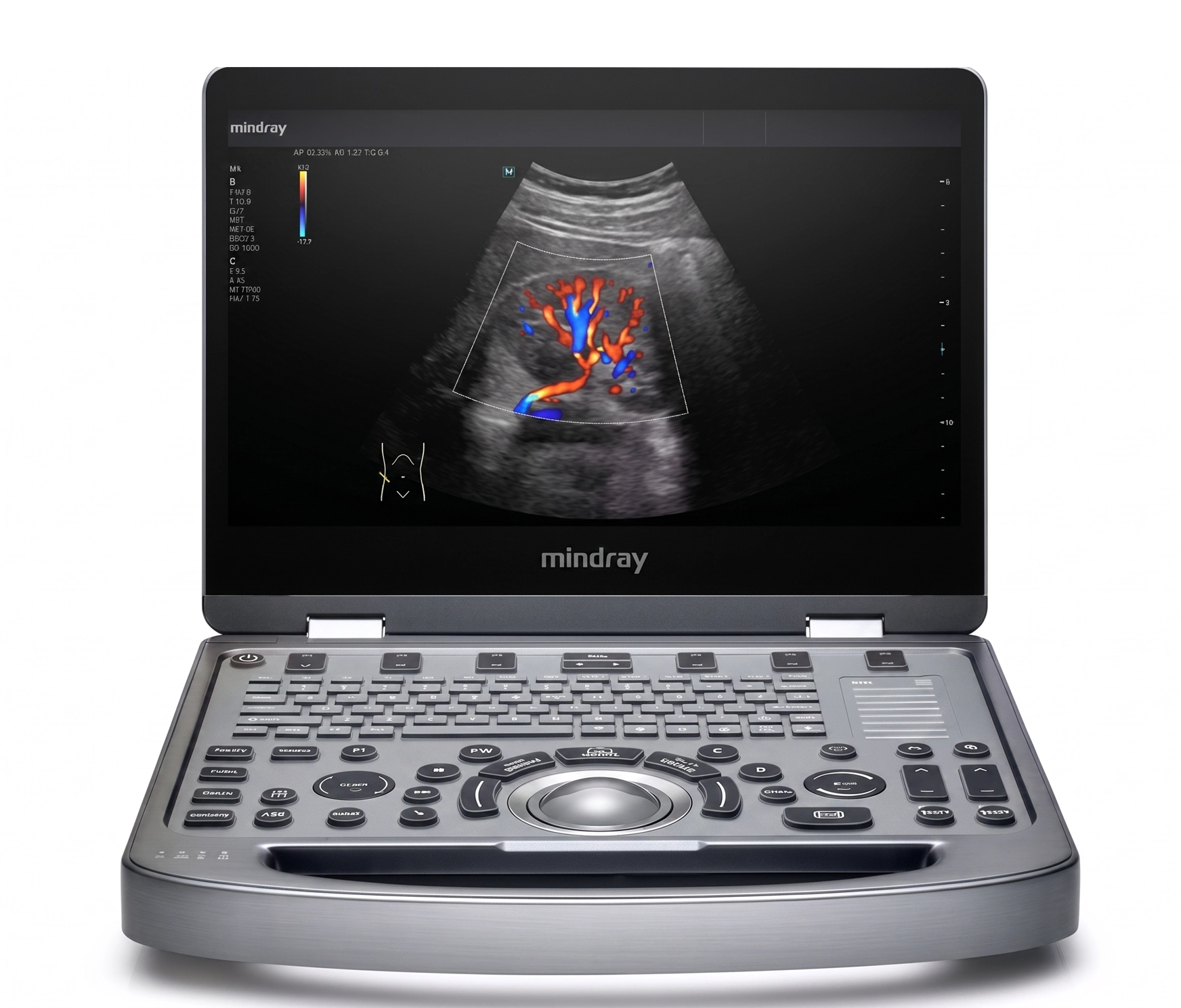 Ultrasonido Mindray MX6 - RADIOLOGÍA PORTÁTIL HUMANO