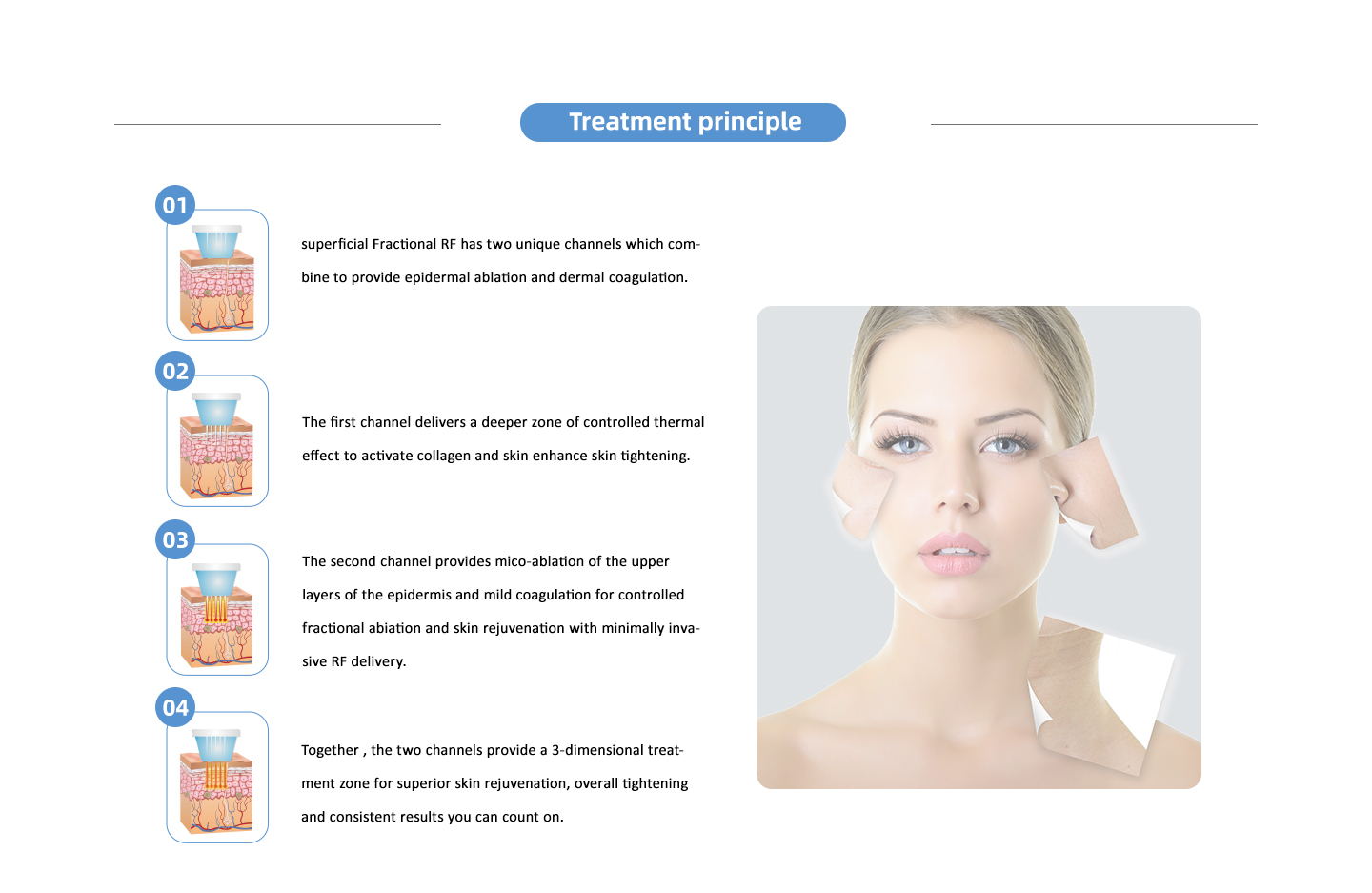 MICRONEEDLE - Nubway