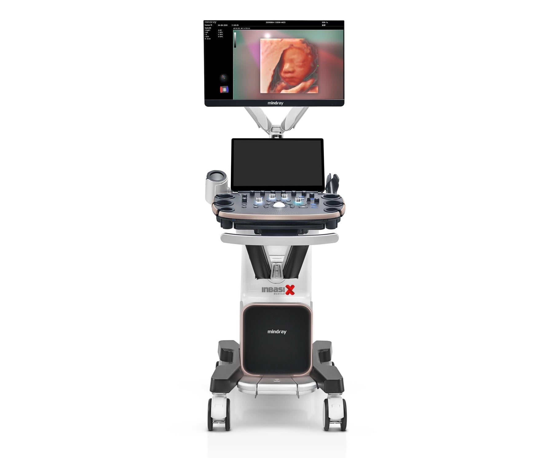 Ultrasonido Mindray NUEWA i9 incluye transductor convexo + endocavitario GINECOLOGÍA GABINETE HUMANO