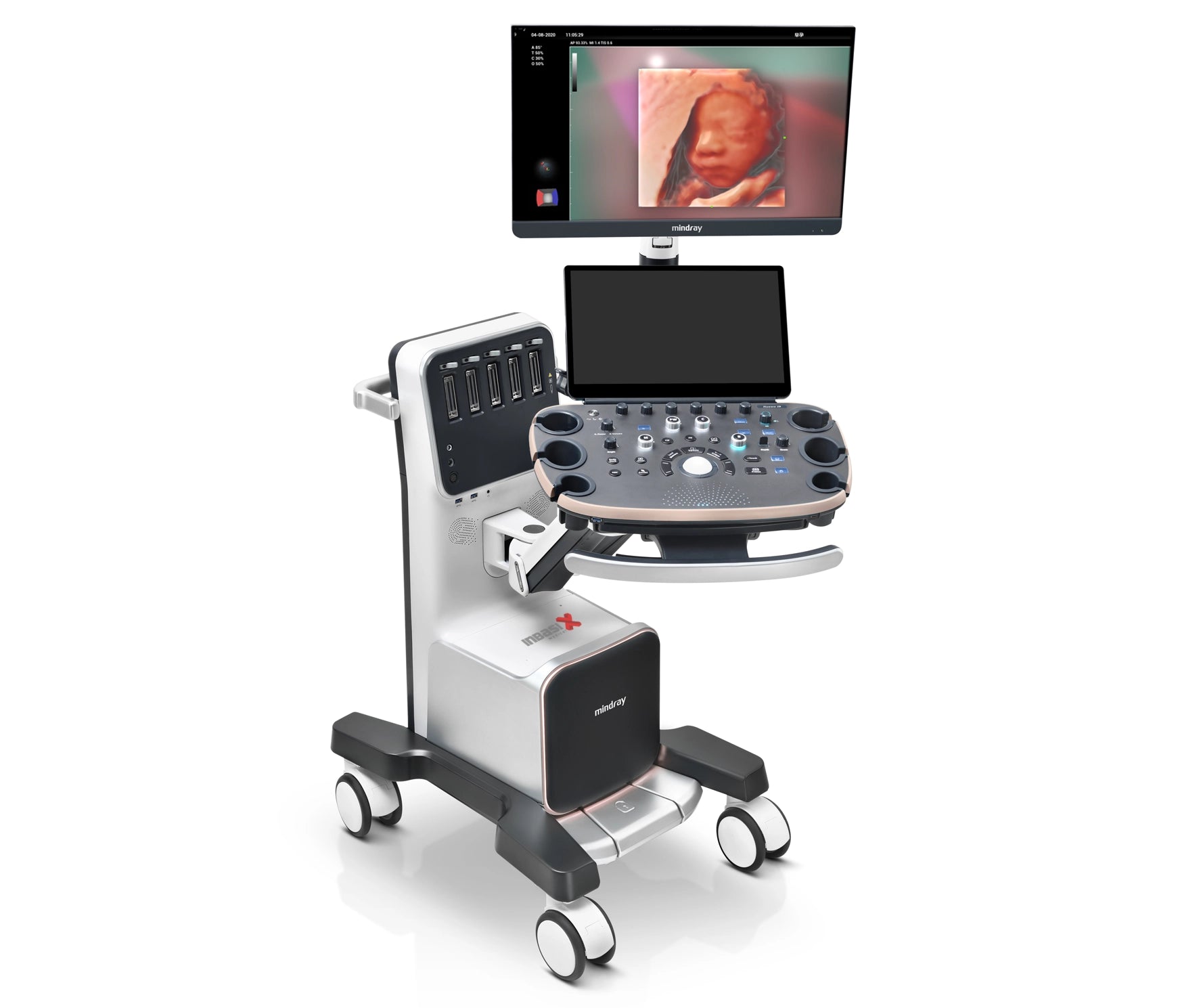 Ultrasonido Mindray NUEWA i9 incluye transductor convexo + endocavitario GINECOLOGÍA GABINETE HUMANO