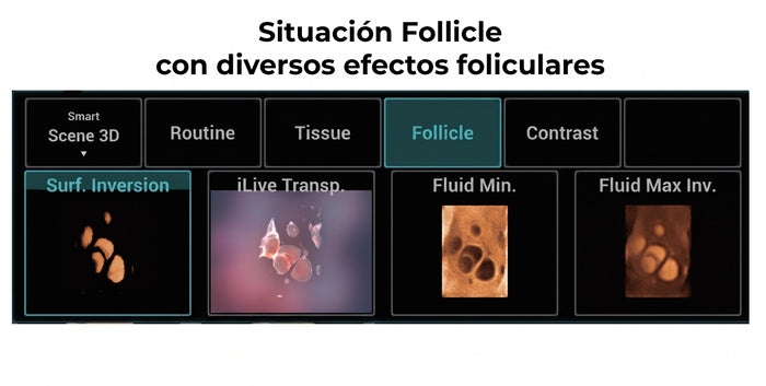 Situación Follicle con diversos efectos foliculares