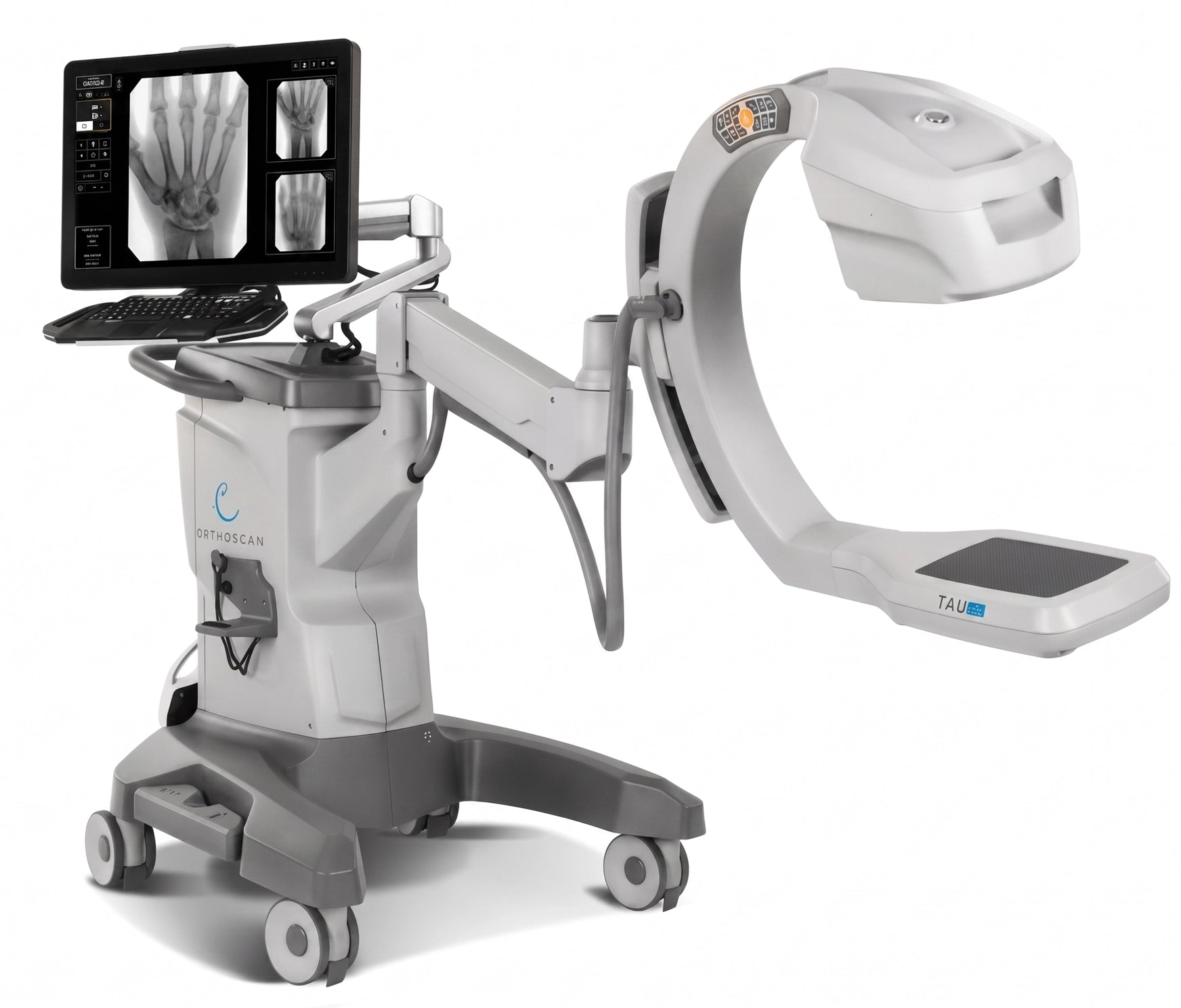 Orthoscan Mini C-Arm - Arco en C