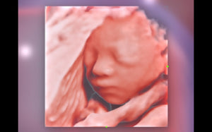 Rostro fetal iLive