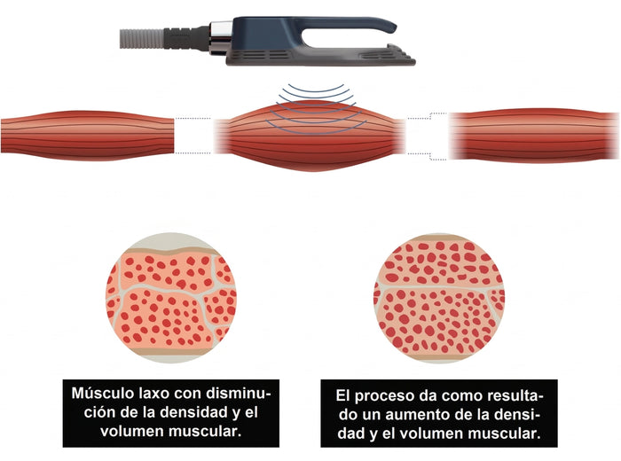 Contracciones musculares