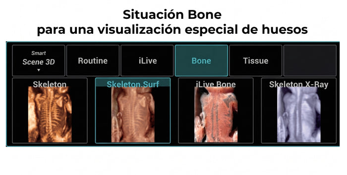 Situación Bone para una visualización especial de huesos
