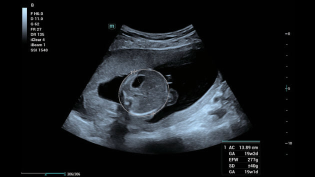 Obstetricia inteligente