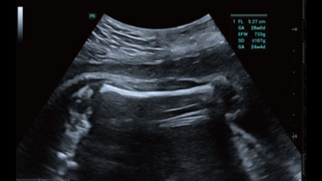 Obstetricia inteligente