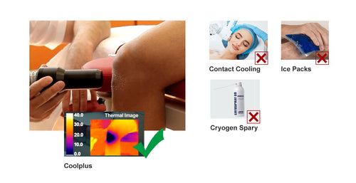 Ventajas de CRYOTERAPY