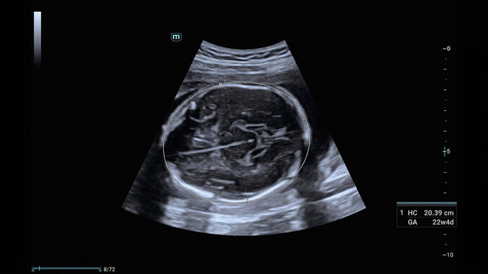 Obstetricia inteligente