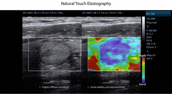 Natural Touch Elastography