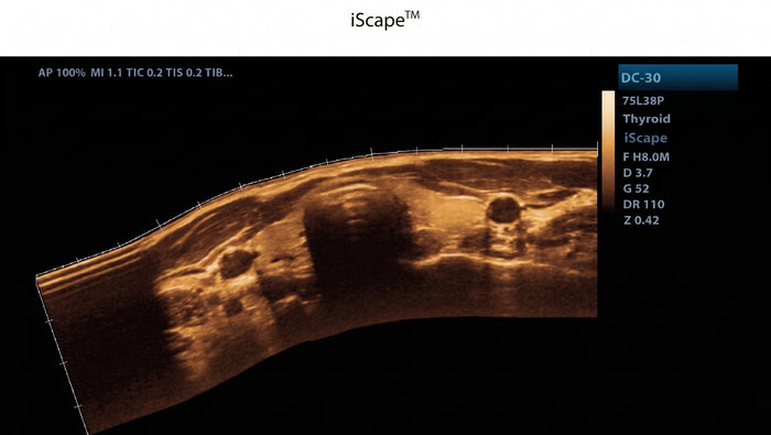 iScape 