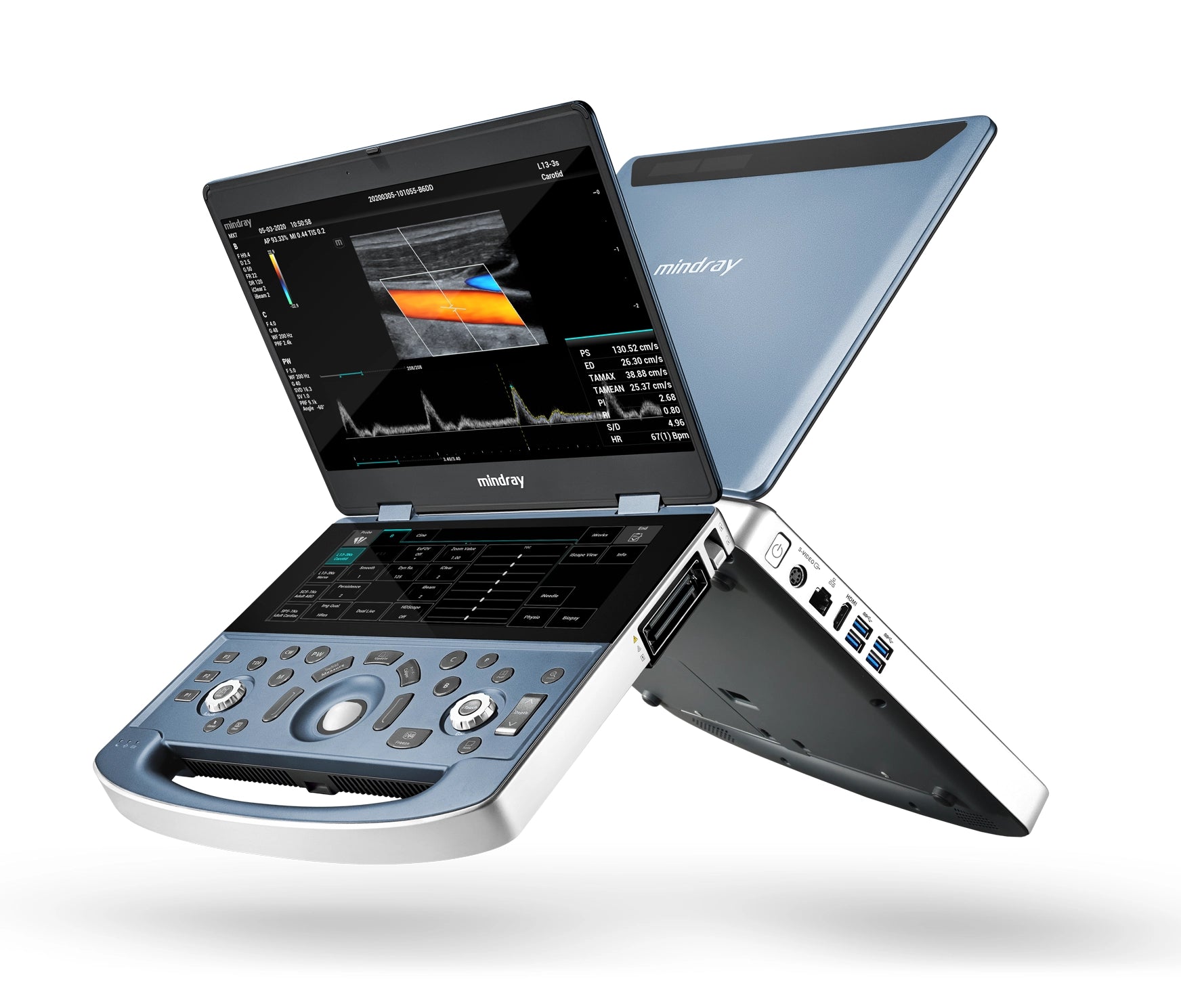 Ultrasonido Mindray MX7 con transductor lineal L20-5S "6-23MHz"- ESTÉTICA PORTÁTIL HUMANO