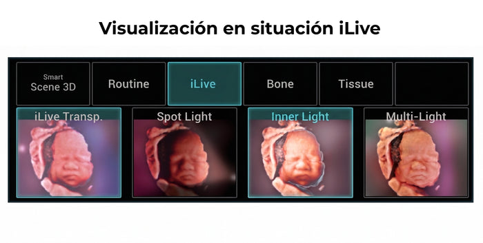 Visualización en situación iLive