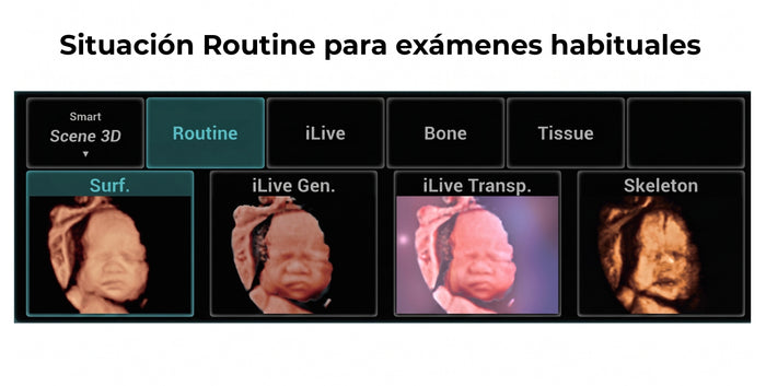 Inigualable facilidad de uso