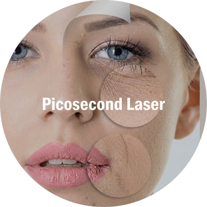 Máquina de Láser de Picosegundos